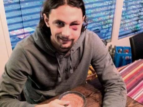 «Ο Κυργιάκος απολογήθηκε με ένα SMS»