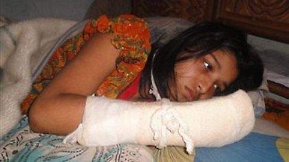 Της έκοψε τα δάχτυλα για να μη μπορεί να σπουδάσει