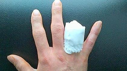 Αφαίρεσε το μισό του δάχτυλο