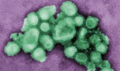 Ανιχνεύθηκε περιστατικό με τον ιό Η1Ν1