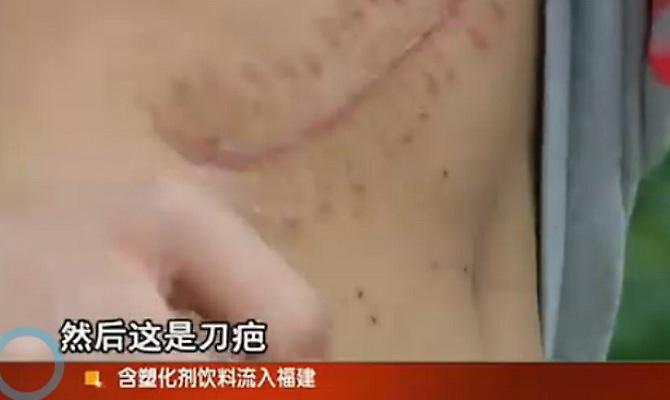 Πούλησε το νεφρό του για να αγοράσει ιPad και iPhone!