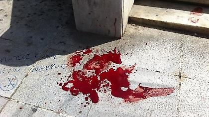 Φοιτητής αυτοκτόνησε με καραμπίνα στη Νάξο