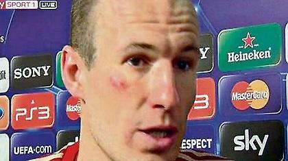 Έπεσαν μπουνιές στη Μπάγερν!