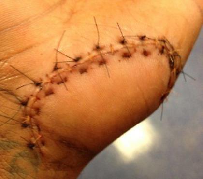 Φθηνά τη γλίτωσε (pic)