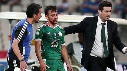 Κάταγμα στη μύτη ο Νίνης