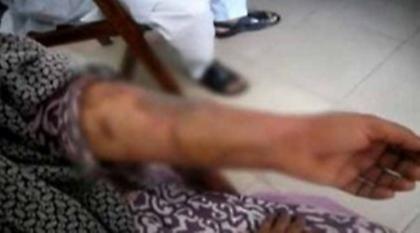 Συναντήθηκε με αγόρι και την σκότωσαν οι γονείς της με οξύ!