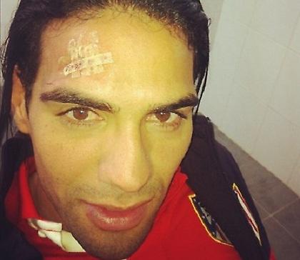 Όλα στραβά για Φαλκάο (video)