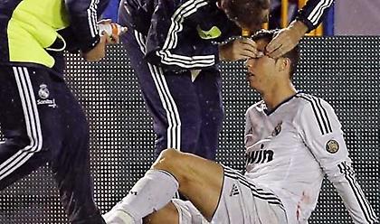 Χάνει το φιλικό o Ρονάλντο