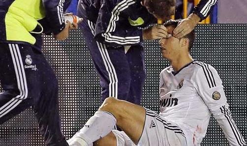 Χάνει το φιλικό o Ρονάλντο