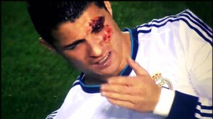 «Δεν ήθελα να χτυπήσω τον Ρονάλντο»