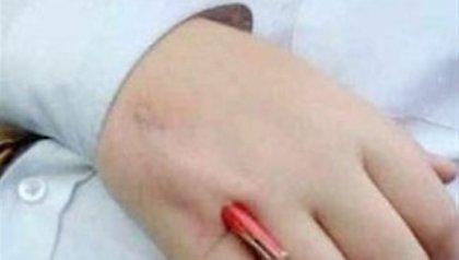 Τον άφησαν για δύο μέρες με καρφωμένο μολύβι στο χέρι του