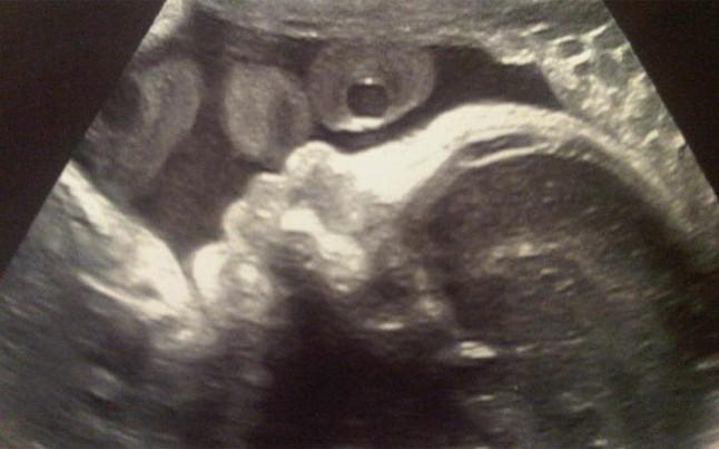 Ιδού ο γιος του Πικέ και της Σακίρα