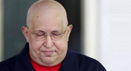 Σε κώμα έχει πέσει ο Τσάβες