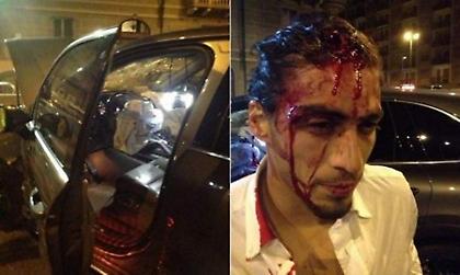 Πώς τη γλίτωσε;