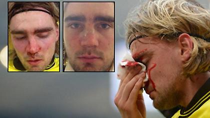 Μασκοφόρος… Σμέλτσερ (video)