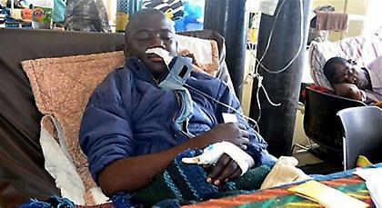 Μεταλλωρύχος δάγκωσε πύθωνα και γλύτωσε το θάνατο