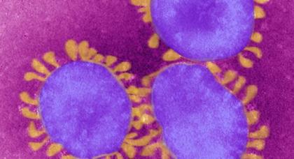 Απειλή για όλο τον κόσμο ο νέος κορονοϊός τύπου SARS