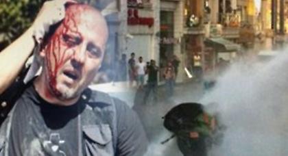 Κωνσταντινούπολη: Ένας φοιτητής νεκρός σε αιματηρά επεισόδια