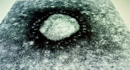 Το πρώτο κρούσμα του κορονοϊού στην Ιταλία