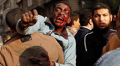 Λουτρό αίματος στο Κάιρο