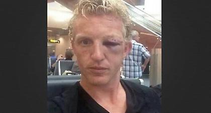 Μετωπική στην Ολλανδία (video)