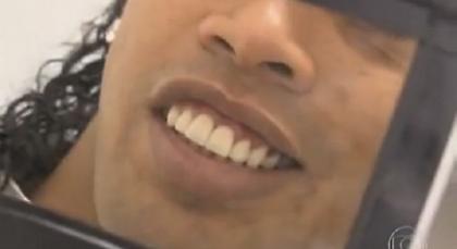 Το νέο χαμόγελο του Ροναλντίνιο (video)