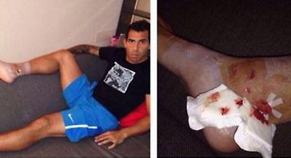 Η «σκαριά» του Ιμόμπιλε στο πόδι του Τέβες! (pics/video)