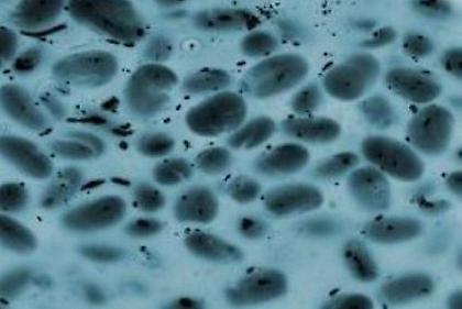 Έφτιαξαν βενζίνη από… μικρόβια