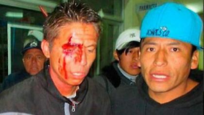 Έδειραν παίκτη, τη γυναίκα και τον γιο του για ένα χαμένο πέναλτι