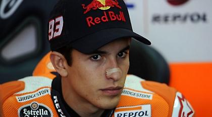 Επέμβαση στη μύτη για Μάρκεθ