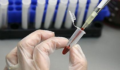 Τεστ αίματος προβλέπει άνοια και Αλτσχάιμερ