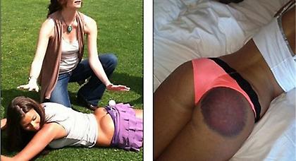 Το μπαστούνι του γκολφ βρήκε αντί για τη μπάλα τα οπίσθιά της