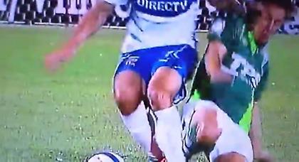 Τραυματισμός που ανατριχιάζει (video)