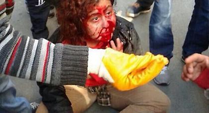 Κωνσταντινούπολη: Επεισόδια και τραυματίες στις πορείες για την Πρωτομαγιά