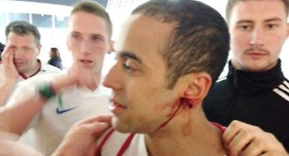 Επίθεση α λα... Σουάρες στις κερκίδες (video)