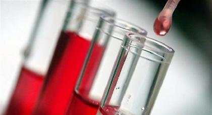 Τεστ αίματος για την έγκαιρη πρόβλεψη του Αλτσχάιμερ