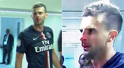 Τις... έφαγε από Μπραντάο ο Μότα! (video)