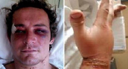 Dj καταγγέλει ξυλοδαρμό από αστυνομικούς!