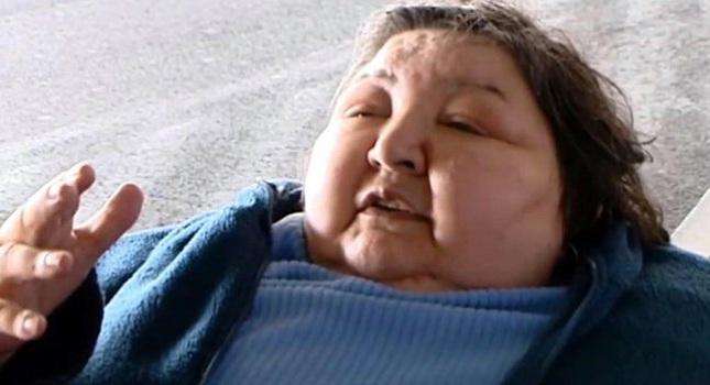 Την άφησαν να πεθάνει γιατί ήταν παχύσαρκη και ανάπηρη