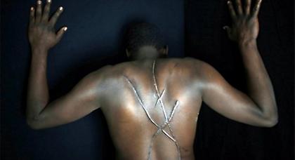 «Προπύργιο του ρατσισμού στην Ευρώπη η Ελλάδα»