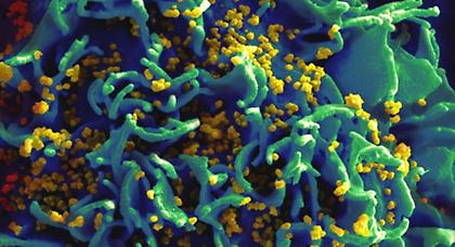 Γαλλία: Δύο φορείς του HIV «αυτο-θεραπεύτηκαν» από τον ιό