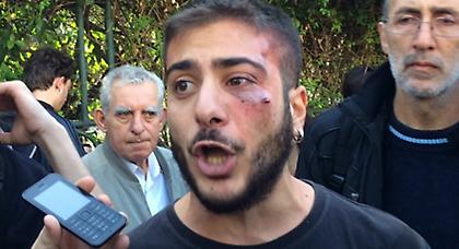 Επίθεση ΜΑΤ σε φοιτητές της Νομικής (video, pics)