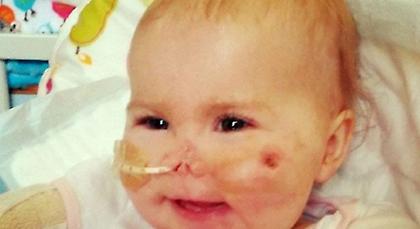 Μωρό «νικάει» τη μηνιγγίτιδα