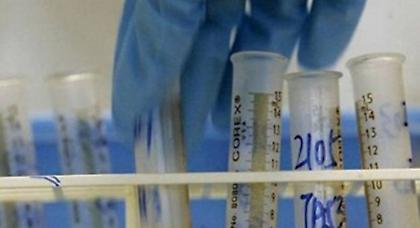 Αυξάνεται ο αριθμός των ντοπέ αθλητών