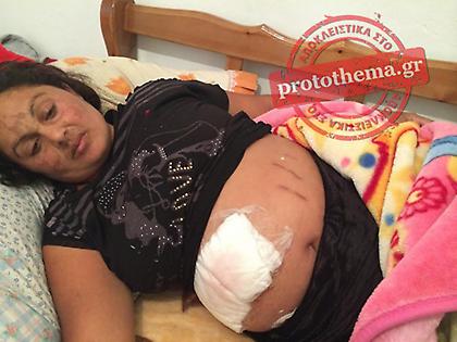 Σοκ στα Πατήσια: Ληστές μαχαίρωσαν έγκυο στην κοιλιά