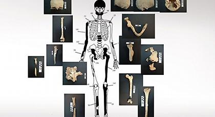 Το μυστήριο και οι απαντήσεις με τους πέντε σκελετούς στην Αμφίπολη