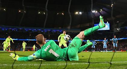 Η αχίλλειος πτέρνα του Μέσι