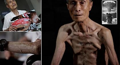 Εικόνες-σοκ από επιζήσαντα του Ναγκασάκι (pics)