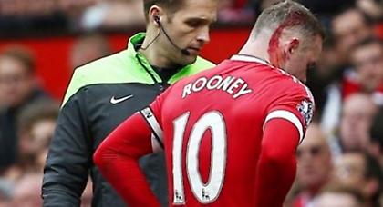 Γλίτωσε… αναίμακτα η Σίτι! (video)