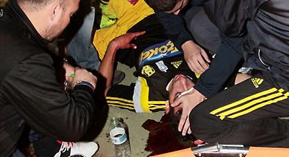 Χαμός στην Καρδίτσα! Αιμόφυρτος στο έδαφος παίκτης της Αναγέννησης  (pics)